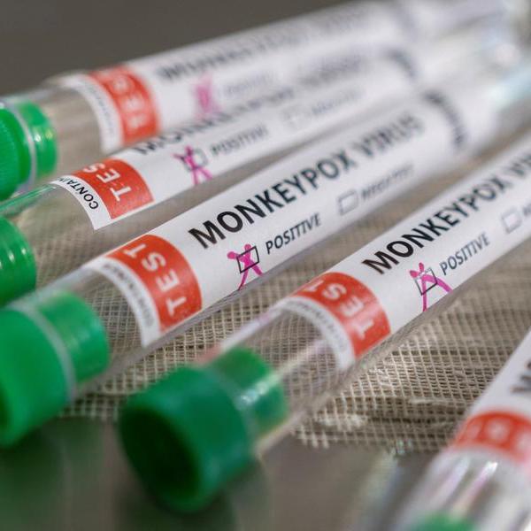 Africa officials urge readiness for monkeypox vaccinations, fair access