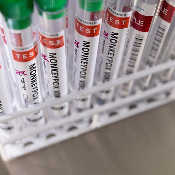 U.S. government declares monkeypox outbreak a public health emergency