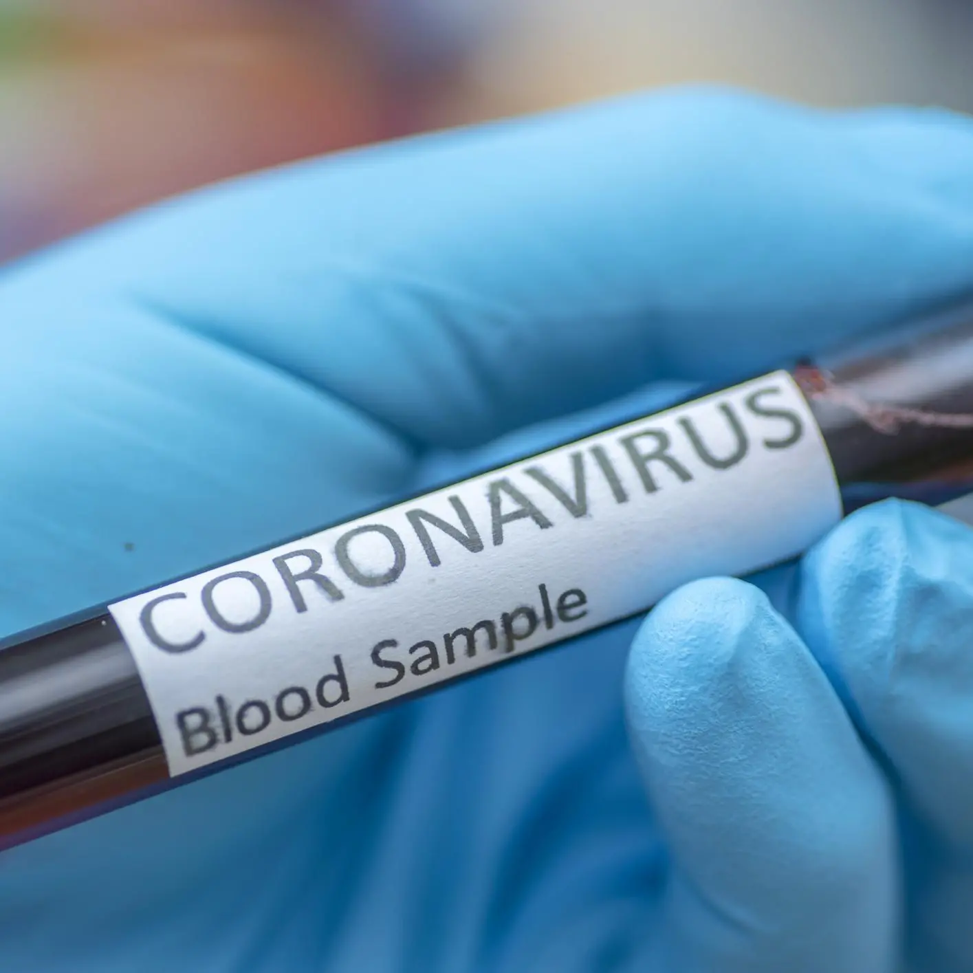 أهم الأخبار: العالم يسجل أكبر عدد إصابات بفيروس كورونا في يوم واحد
