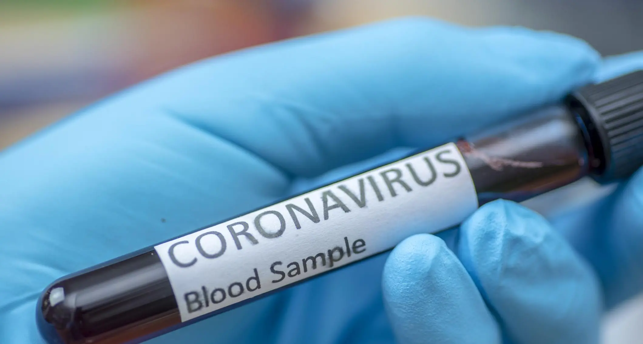 أهم الأخبار: العالم يسجل أكبر عدد إصابات بفيروس كورونا في يوم واحد