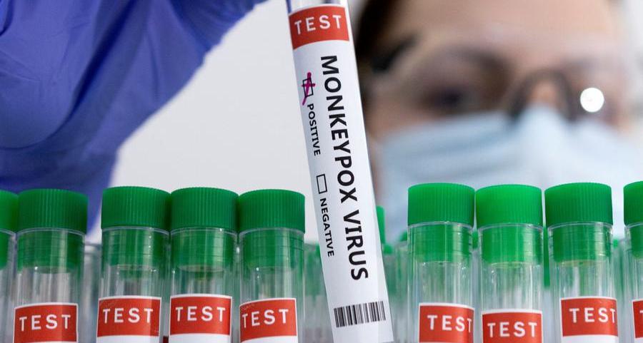 U.S. expanding monkeypox testing capacity as cases rise