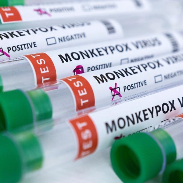 Monkeypox outbreak can be eliminated in Europe