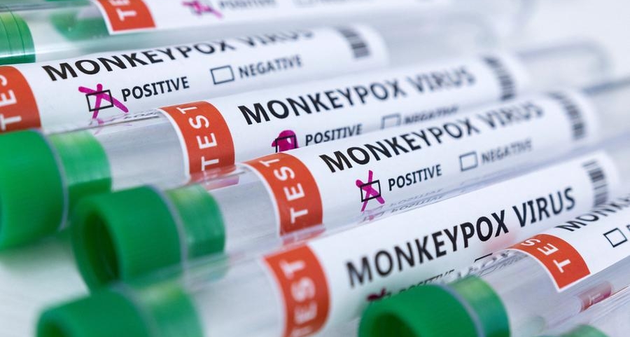 Monkeypox outbreak can be eliminated in Europe