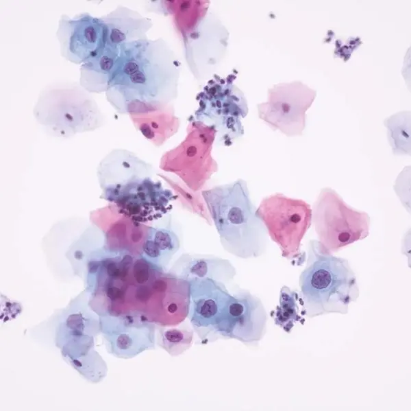 Unilabs Middle East launches region's first AI-powered digital cytology technology in UAE