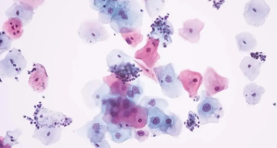 Unilabs Middle East launches region's first AI-powered digital cytology technology in UAE