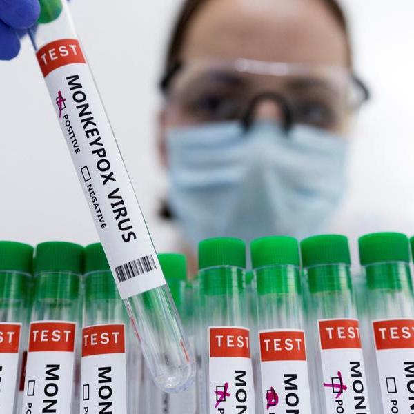 U.S. to buy Siga's IV drug worth $26 mln to fight monkeypox outbreak