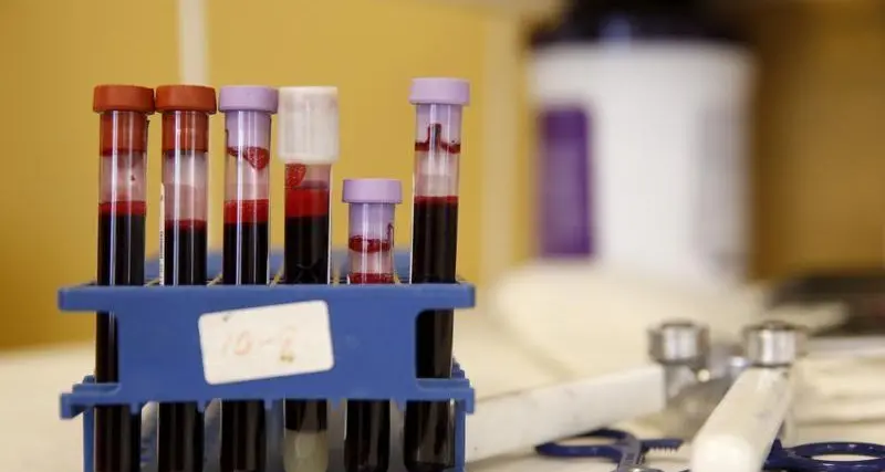 علماء ينجحون في الحصول على الكهرباء من دم الإنسان