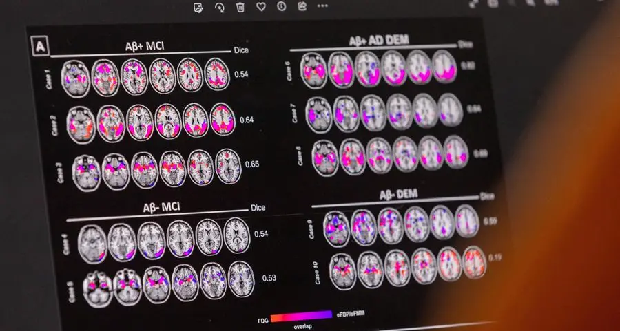 Biogen to cut 1,000 jobs to save costs as Alzheimer's drug launch gathers pace