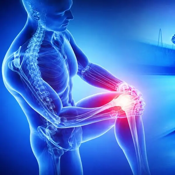 International Orthopaedics & Sports Surgery Conference 2026 to launch in Jeddah on 6 February