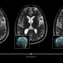 Al Qassimi Hospital upgraded with UAE's first deployment of award-winning AIR Technology