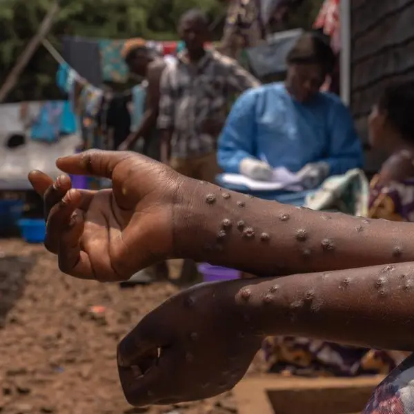 Mpox outbreak: DR Congo lacks vaccines to curb infections