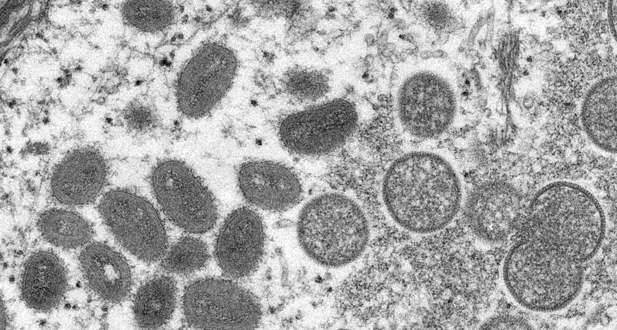 'Early signs' monkeypox outbreak plateauing in UK, health authority says