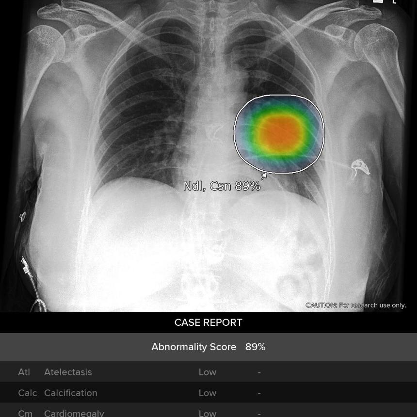 شراكة بين \"لونيت\" و\"صحة\" لاختبار تقنية أشعة قائمة على الذكاء الاصطناعي عبر أكبر شبكة للرعاية الصحية في الإمارات