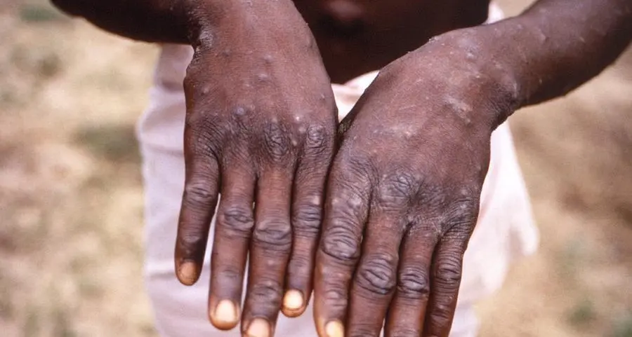 Africa Center for Disease Control and Prevention declares mpox public health emergency