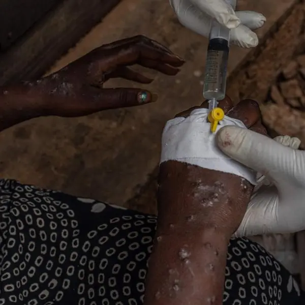 Africa CDC confident it can raise $600mln for mpox response