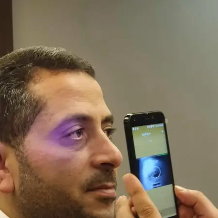 Zain Cash, UNHCR and IrisGuard collaborate to introduce iris technology for cash disbursements to refugees in Iraq