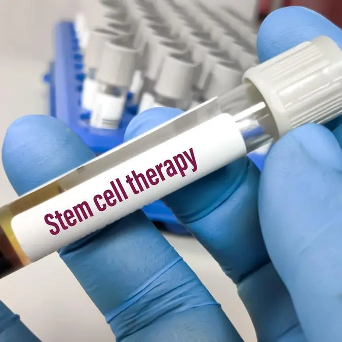 KMC first in Qatar to offer stem cell therapy to public