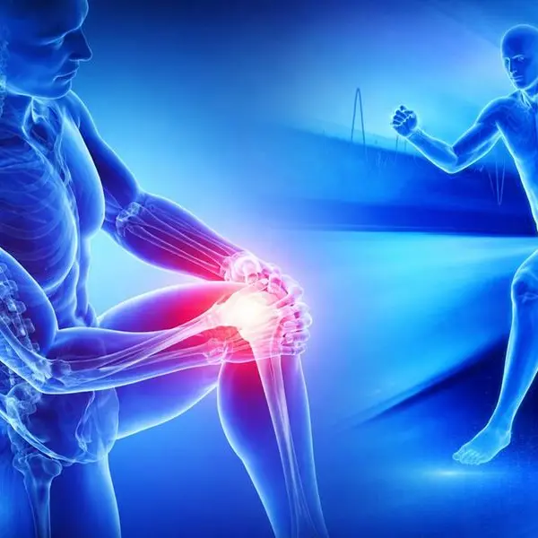 المؤتمر الدولي لجراحة العظام والطب الرياضي ينطلق في جدة 6 فبراير