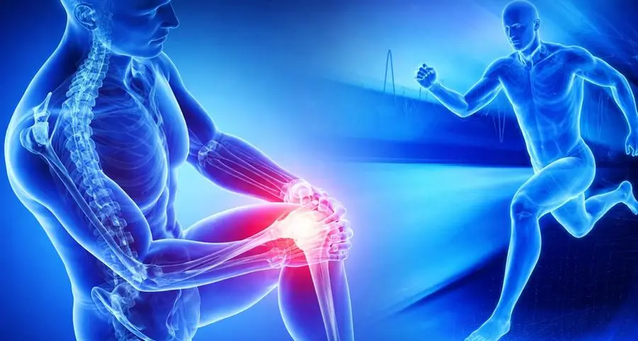 المؤتمر الدولي لجراحة العظام والطب الرياضي ينطلق في جدة 6 فبراير