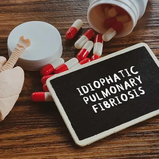 Emirates Drug Establishment approves innovative treatment for idiopathic pulmonary fibrosis