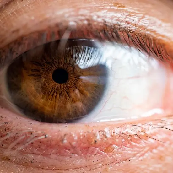 Corneal transplants are safer and more precise than ever at Barraquer Eye Hospital UAE