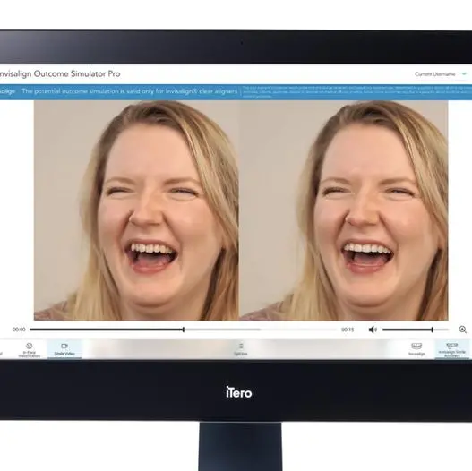 Align Technology announces new innovations for iTero Digital Solutions