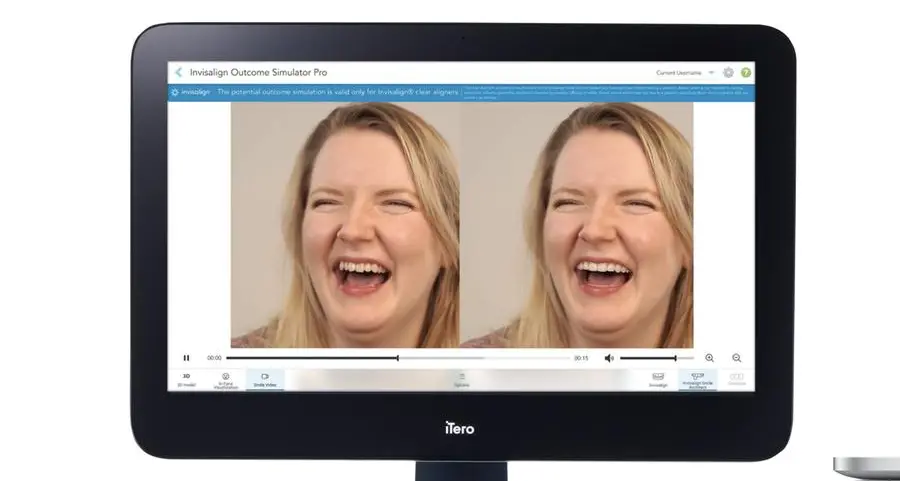 Align Technology announces new innovations for iTero Digital Solutions