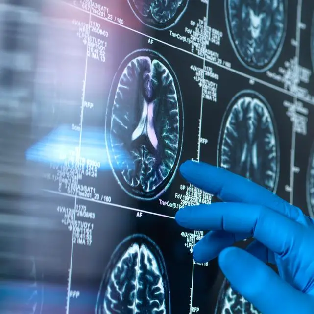 M42’s IROS launches UAE’s first genomics-driven clinical trial to prevent Alzheimer’s disease