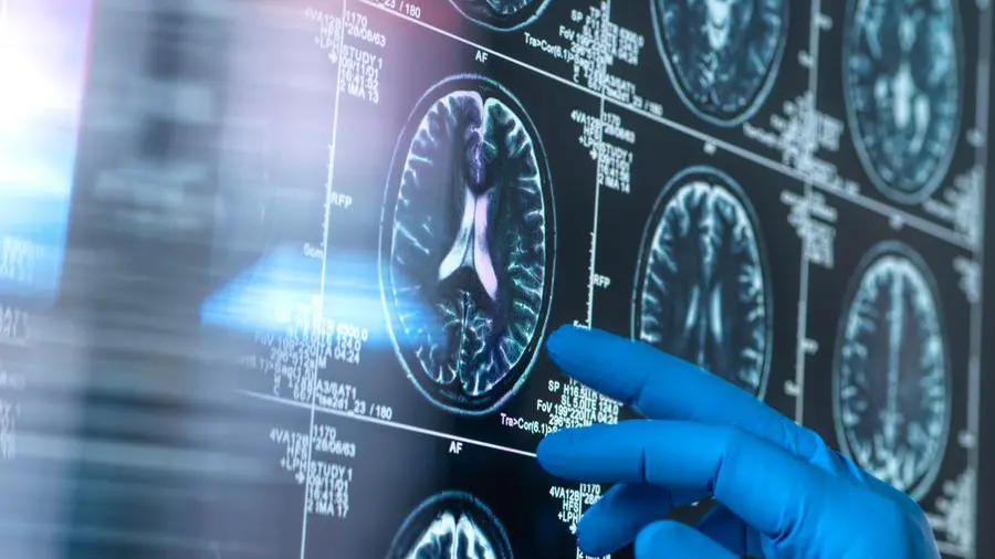 M42’s IROS launches UAE’s first genomics-driven clinical trial to prevent Alzheimer’s disease
