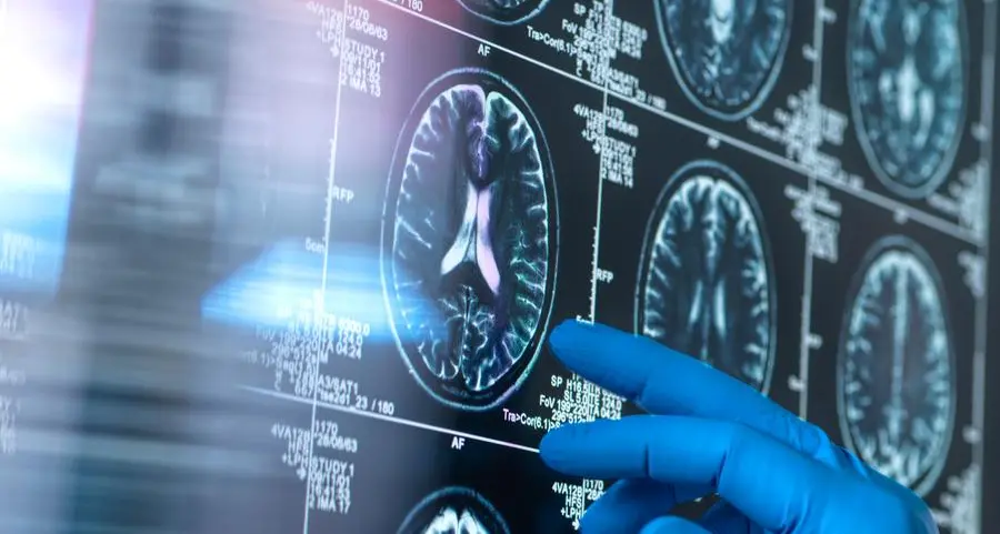 M42’s IROS launches UAE’s first genomics-driven clinical trial to prevent Alzheimer’s disease