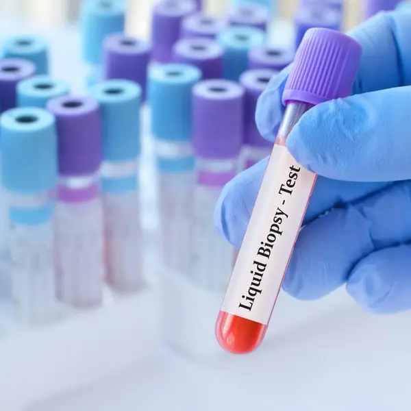 M42, partners launch liquid biopsy testing in UAE