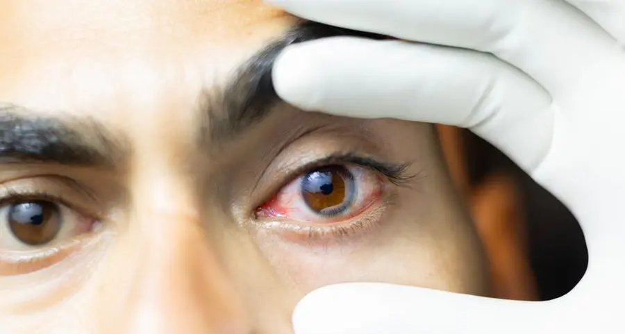 Abu Dhabi Biobank, Bascom Palmer Eye Institute partner to establish Middle East's first Eye Bank in Abu Dhabi