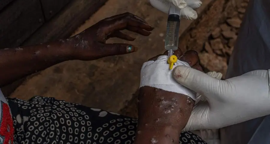 Africa CDC confident it can raise $600mln for mpox response