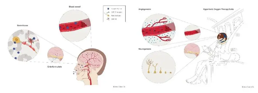 Figure-1 - The potential penetration routes of COVID-19 virus to the brain. Once penetrating, the virus can bind and cause damage to neurons and glia cells. In addition, within the blood vessels, the virus can induce thrombus formation causing brain infracts.\\nFigure-2 - The repair mechanisms induce by Hyperbaric oxygen therapy: Angiogenesis (generation of new blood vessels) and neurogenesis (generation of new neurons)