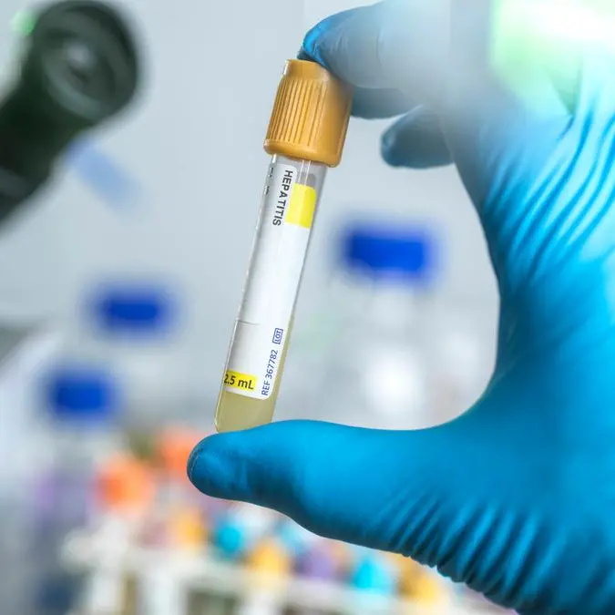 Saudi health ministry launches inspections of expatriate worker and food labor screening centers