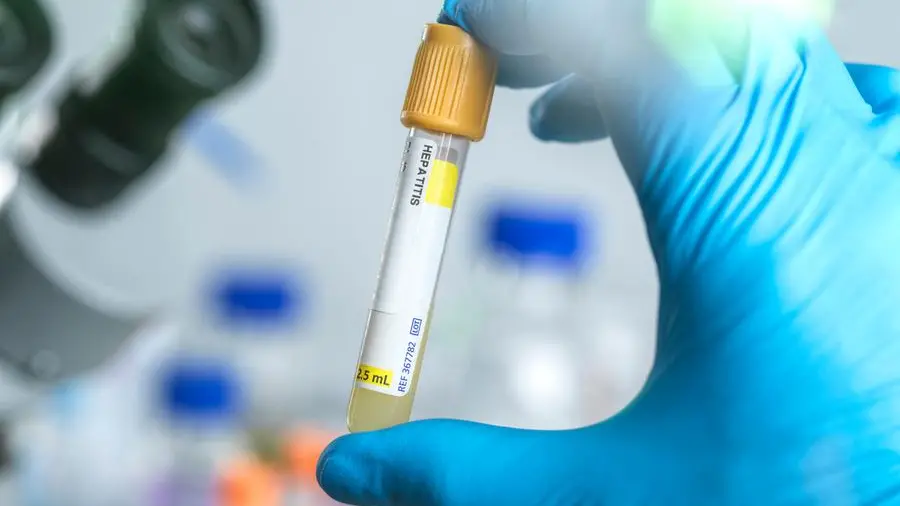 Saudi health ministry launches inspections of expatriate worker and food labor screening centers