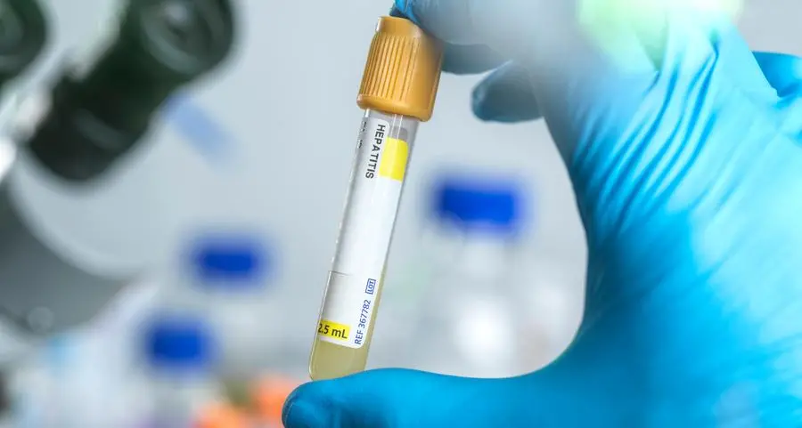 Saudi health ministry launches inspections of expatriate worker and food labor screening centers