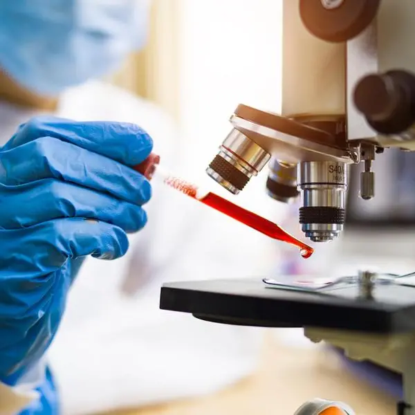 Al Shroouk Scan seeks $20mln to expand diagnostics network in Egypt