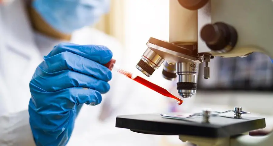Al Shroouk Scan seeks $20mln to expand diagnostics network in Egypt