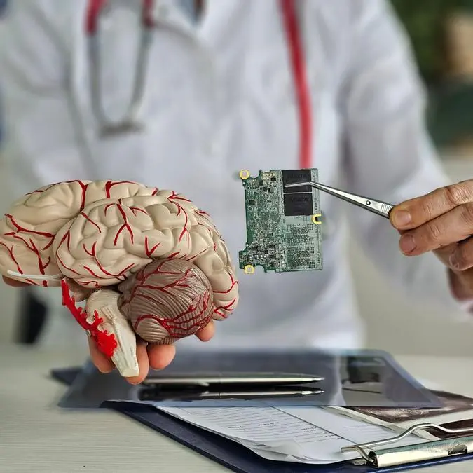 Riyadh hospital pioneers AI device implant for brain stimulation