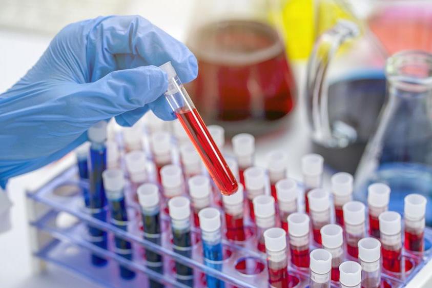 Abu Dhabi launches new national achievement for blood toxicology testing