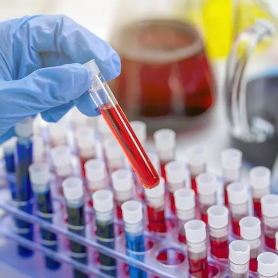 Egypt’s Al Mokhtabar installs fully automated haematology line at central laboratory