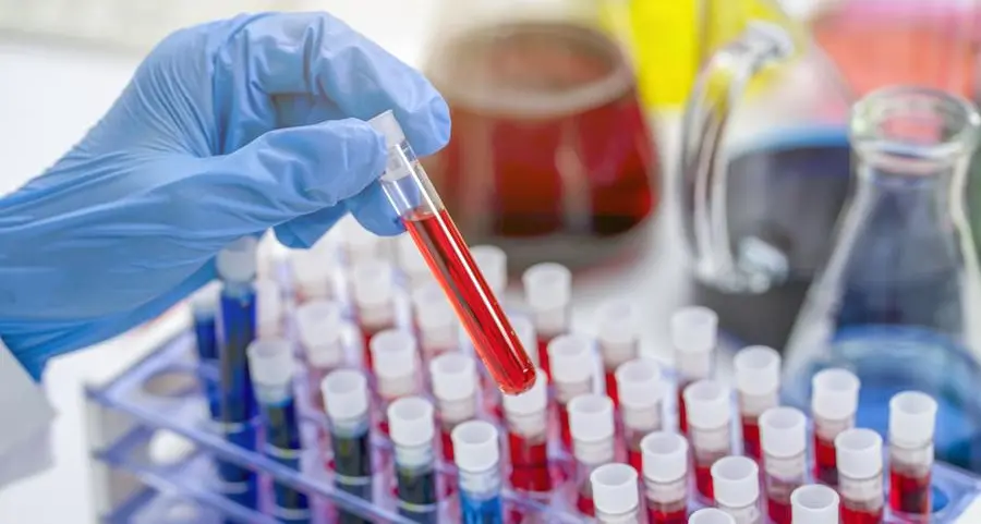 Egypt’s Al Mokhtabar installs fully automated haematology line at central laboratory